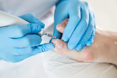 Gabinet Podologiczny PODOMART